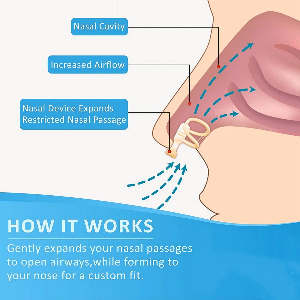 Anti Russare Dilatatore Nasale - Anti Snore Contour Pillow recensione e prezzo